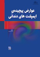 عوارض پیچیده ایمپلنت های دندانی